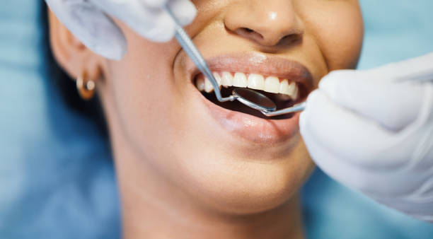 Best Emergency Dental Extractions in Groveport, OH